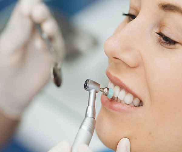 Teeth Whitening